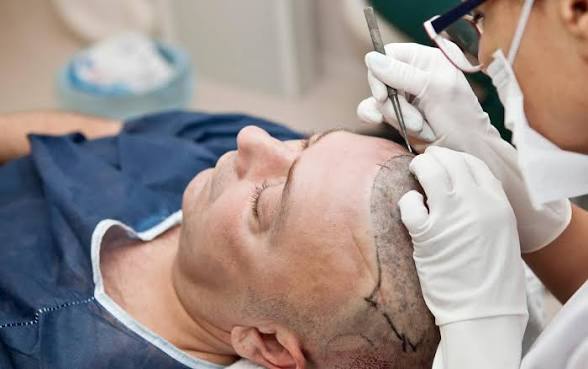 Aesthetic and Hair Transplant surgery