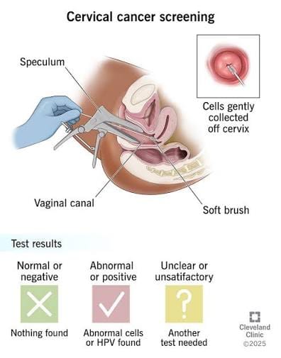 CERVICAL CANCER AND PRE CANCER DETECTION
