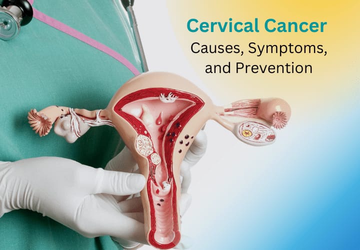CERVICAL CANCER PREVENTION