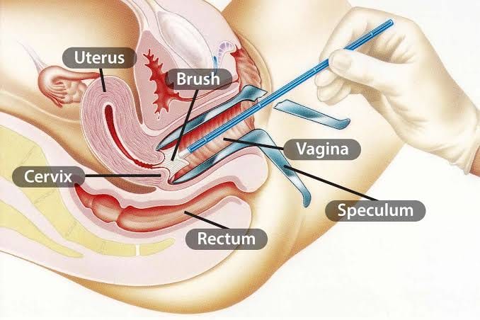 PAP SMEAR